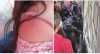 Suman 41 las denuncias por pinchazos en el Metro y Metrobús #regionmx